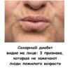 Сахарный диабет видно на лице: 3 признака, которые не замечают люди пожилого возраста