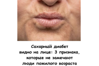 Сахарный диабет видно на лице: 3 признака, которые не замечают люди пожилого возраста