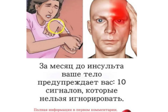 Врачи предупреждают: инсульт начинается за 30 дней, но мало кто это понимает